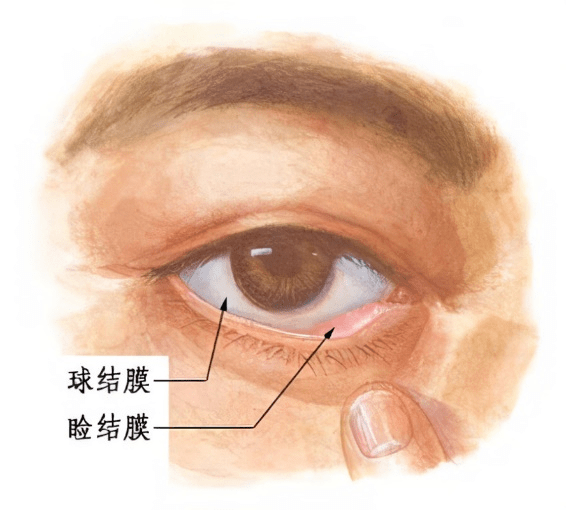 手机有病毒怎么办:【健康知识进万家】春季眼红发痒 可能是过敏惹的祸-第3张图片-太平洋在线下载